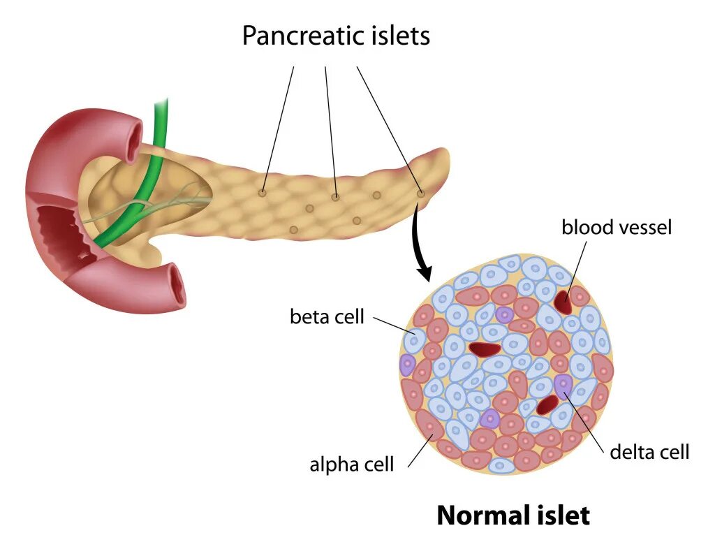 Бета клетки поджелудочной железы. Β-клетки поджелудочной железы.. Деструкция клеток поджелудочной железы. Разрушение бета клеток поджелудочной железы. Пересадка поджелудочной при диабете