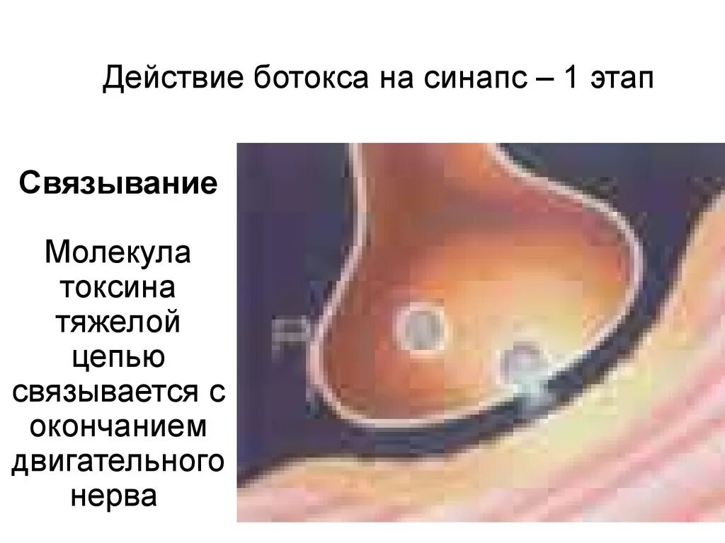 Схема строения ботулинического токсина. Механизм действия ботулотоксина стадии. Ботулотоксин химические свойства. Схема введения ботулотоксина. Действие ботулинического токсина.