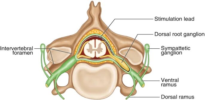 Ganglion prevertebrale. Dorsal root ganglion. Гигрома (синовиальная киста, ганглион).