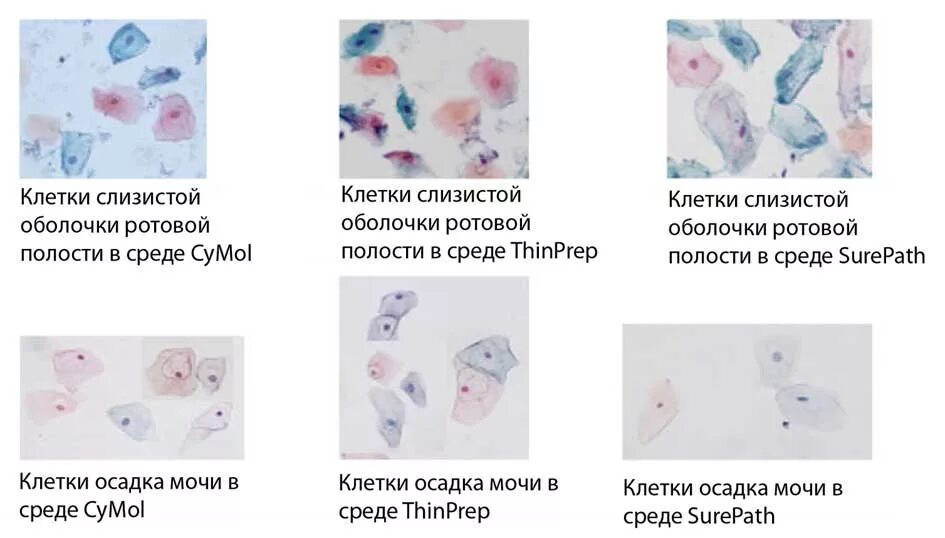 клетки слизистой ротовой полости. клетки плоского эпителия полости рта человека под микроскопом. клетки эпителия слизистой полости рта под микроскопом. клетки слизистой оболочки ротовой полости. строение буккального эпителия.