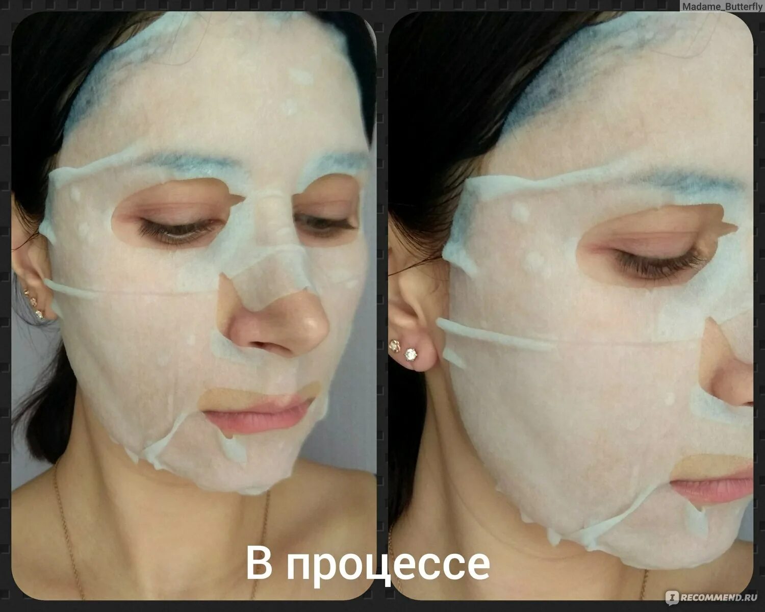 Можно использовать тканевую маску повторно. Mizon cicaluronic Gel treatment. Можно ли на тканевую гиалуроновую маску сверху пакетную?. Можно ли тканевой маской для лица закрывать глаза.