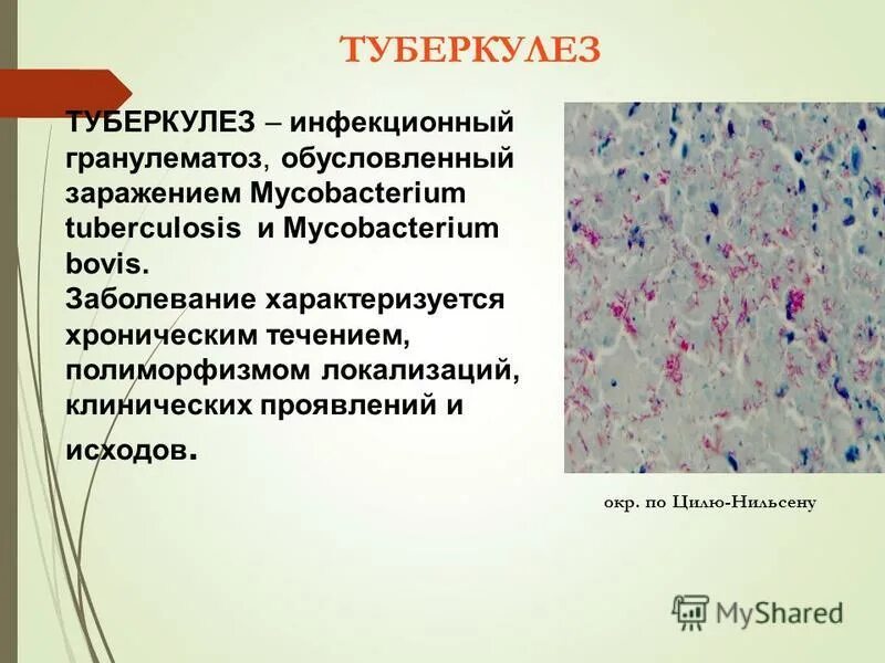 Корь и туберкулез