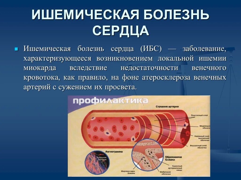 Ишемическая ишемия