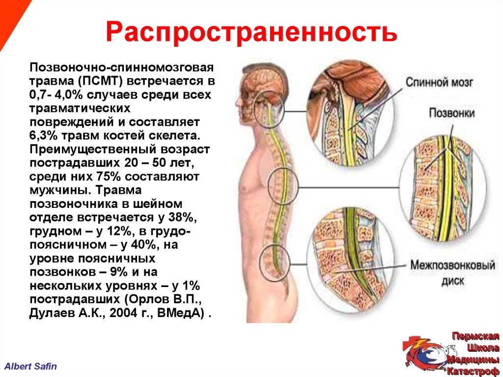 Спинальная травма это. Типы повреждений спинного мозга. Сестринский уход при спинномозговой травме. Спинальная травма это. Спинальная травма это.