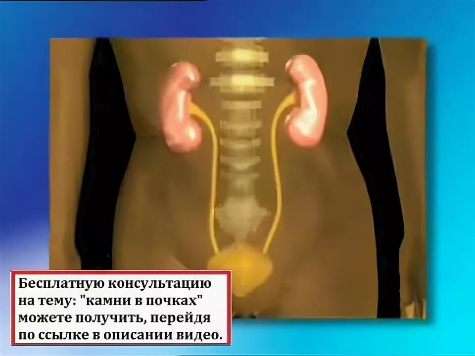 Показать где находятся почки. Где находятся почки. где находятся почки у человека фото. где у человека расположены почки показать фото. расположение почек у человека со спины.