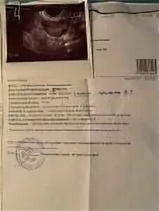 Эндометрий 9 мм. Желтое тело 19 мм эндометрий 11 мм. диаметр желтого тела 11 мм.