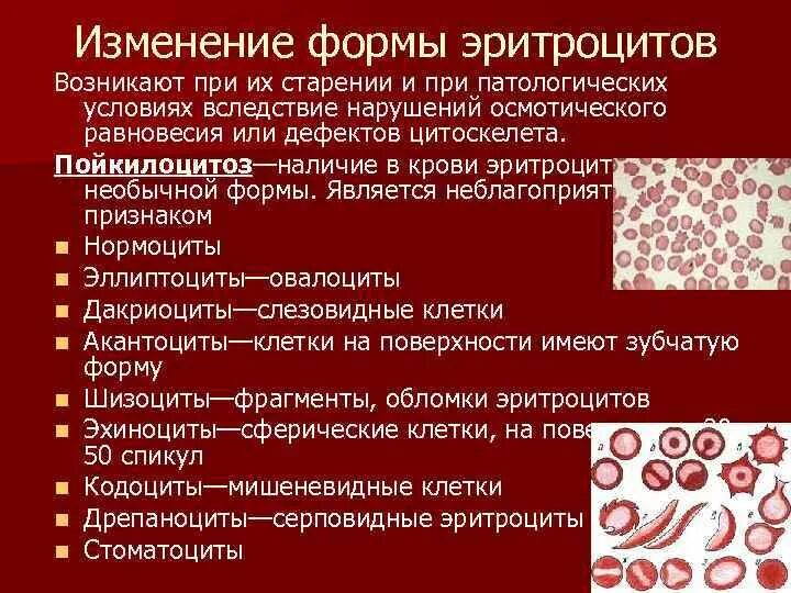 3 признака эритроцитов. Патологические изменения эритроцитов. Форма эритроцитов. Измененные эритроциты в крови. Изменение формы эритроцитов.