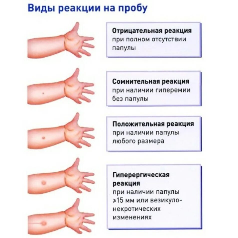 Почему нельзя ставить прививку