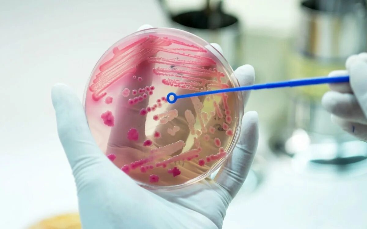 Удаление инфекции. Удаление инфекции. Комплексное лечение септикопиемии. Удаление инфекции. Удаление инфекции.