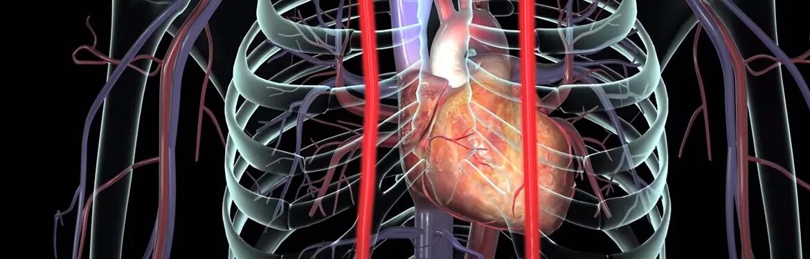 Коронарное шунтирование сосудов сердца. Аорта коронарное шунтирование. Шунтирование и стентирование. Что такое шунтирование сердца и сосудов