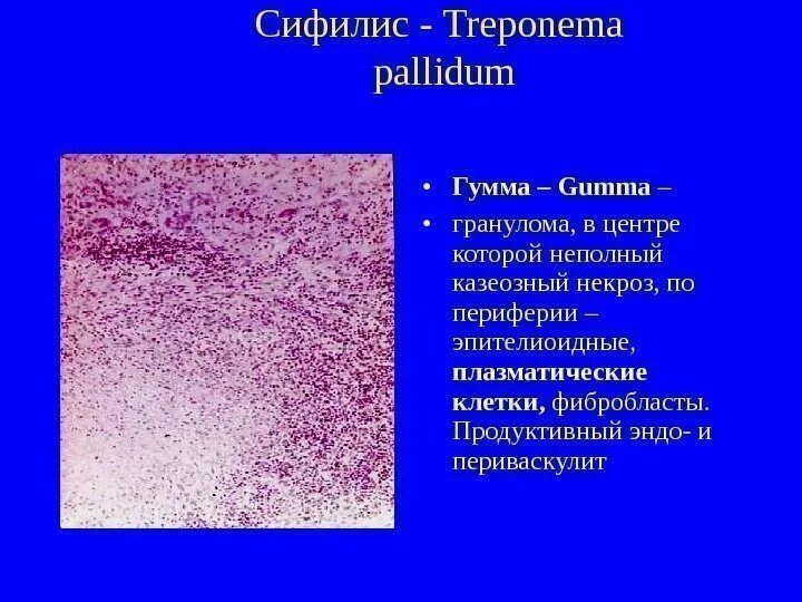 Красный плоский лишай
