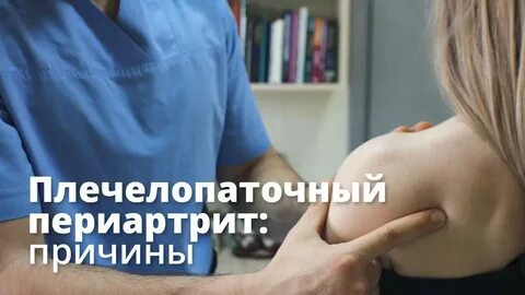 Эффективное лечение плечелопаточного периартрита