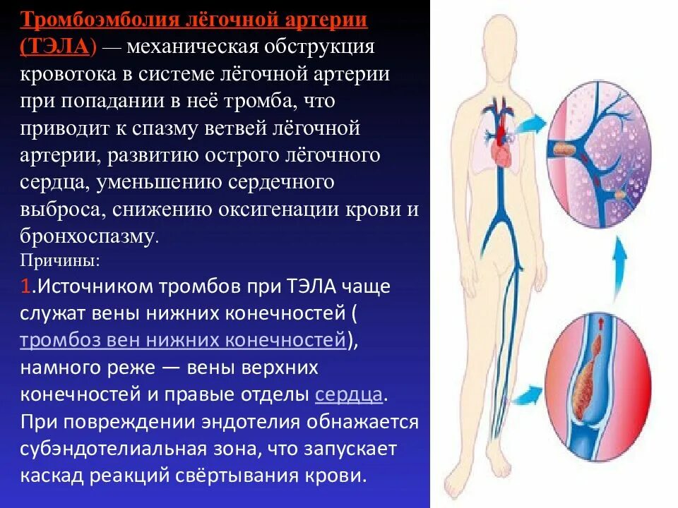 Тромболия легочной артерии. Тромбо легочная эмболия. Тэла осложнение тромбофлебита. Профилактика тромбоэмболии легочной артерии. Тромбоэболиялегосной артерии.