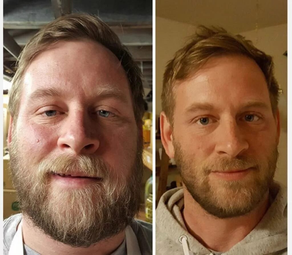 Photos before after. Кевин Иак Калистер до и после. Внешность человека до и после алкоголизма. Лицо алкоголика до и после.
