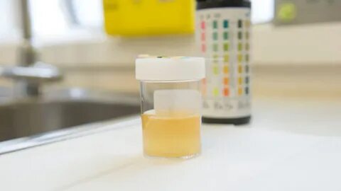 У меня мутная моча: что это - инфекция или другие болезни? О здоровье: с медицин