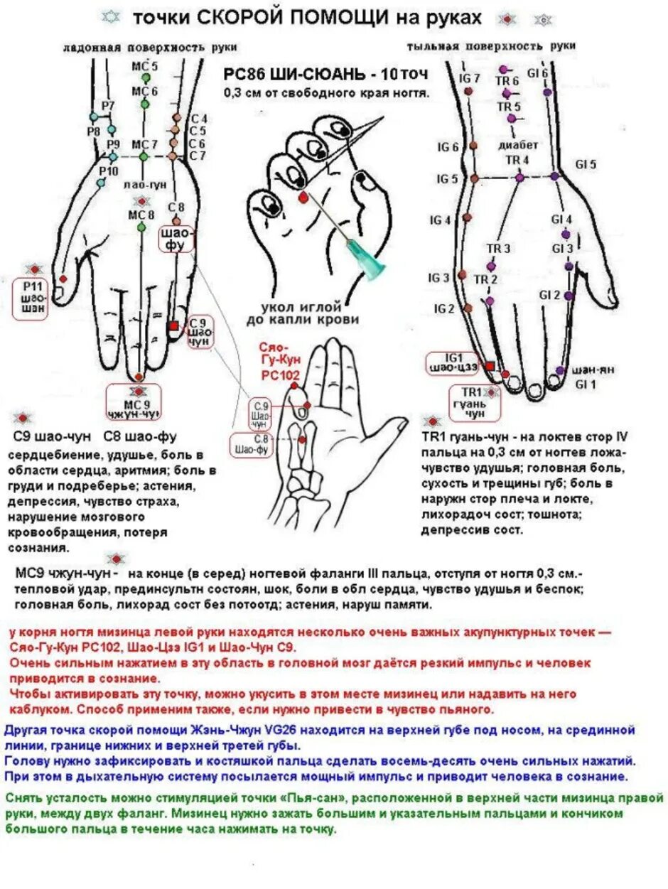 Акупунктура тела человека схема болевые точки. Схема акупунктурных точек при гипертонии. Акупунктурные точки при ДЦП. Точечный массаж схема и описание точек. Точки на руках для массажа