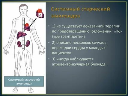 Старческий амилоидоз