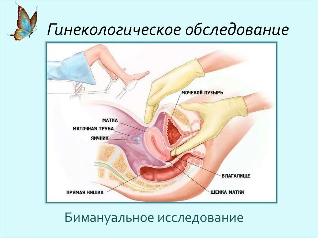 Фото врачей писюлька школьника в вагине Рак влагалища: причины, симптомы и лечение в статье гинеколога Коваленко М. А.