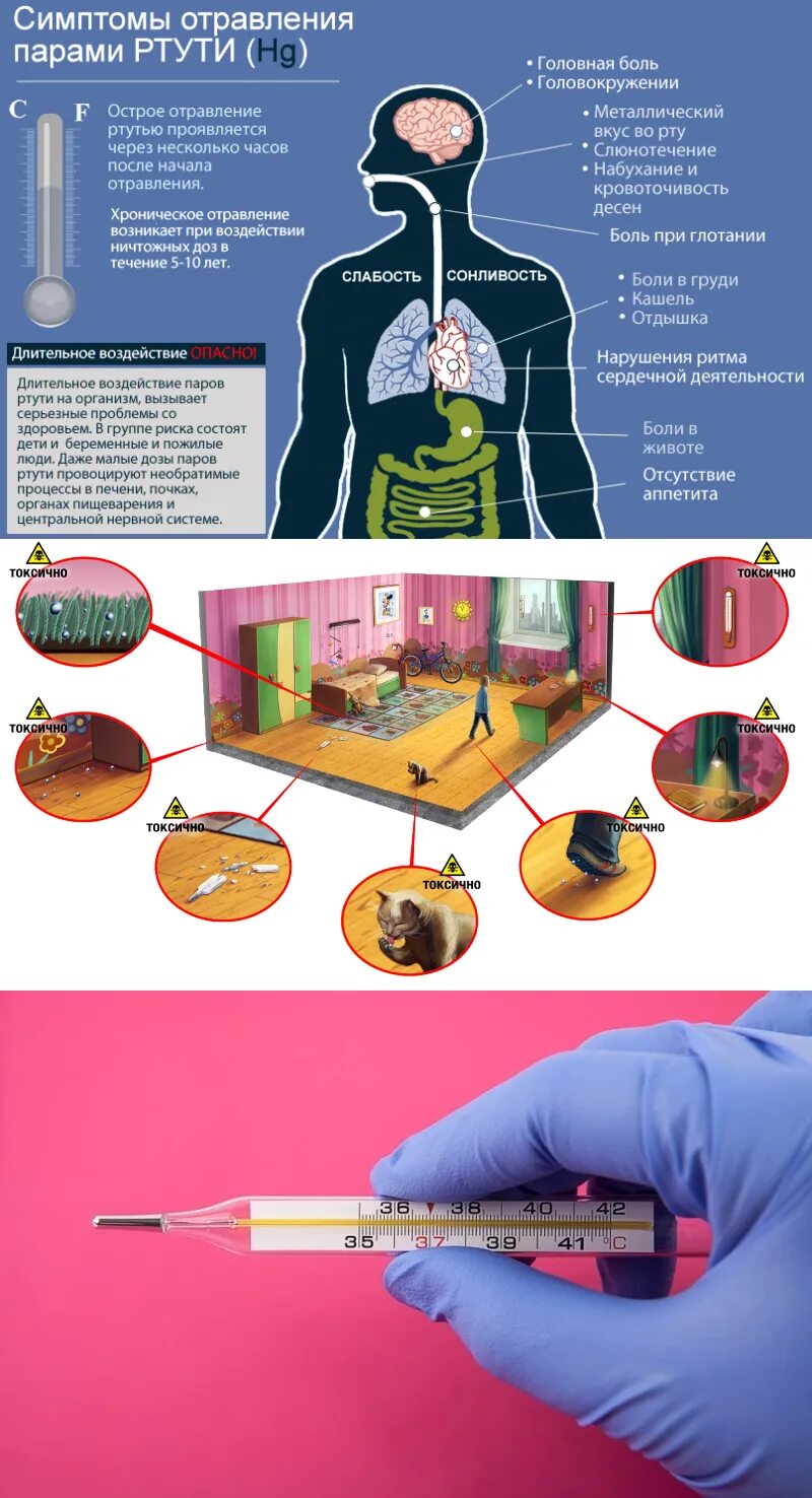Можно ли отравиться градусником. Симптомы отравления ртутью. Интоксикация ртутью. Симптомы при отравлении ртутью. Ртутная интоксикация симптомы.