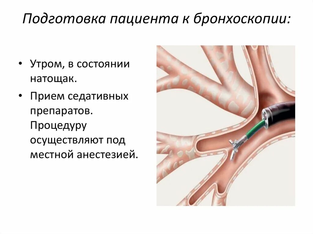 Подготовка к бронхографии алгоритм. Фибробронхоскопия подготовка пациента. подготовка к бронхоскопии памятка для пациента. подготовка пациента к бронхоскопии. бронхоскопия трахеобронхоскопия.