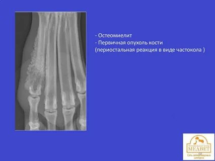Периостальная реакция