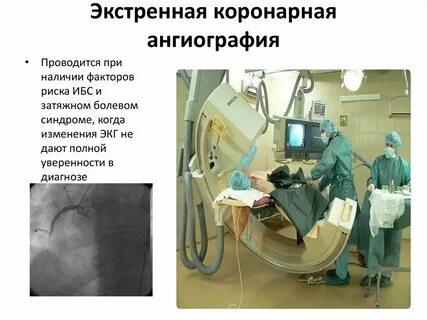 Коронарографии как часто делают