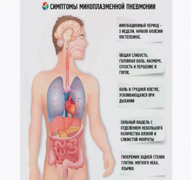 Какие боли при пневмонии