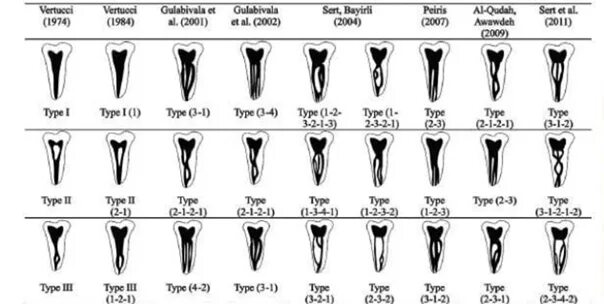 Классификация Вертуччи корневых каналов. Классификация корневых каналов Vertucci. Типы корневых каналов по Вейну. Классификация корневых каналов Vertucci 1984. Формы корневых каналов