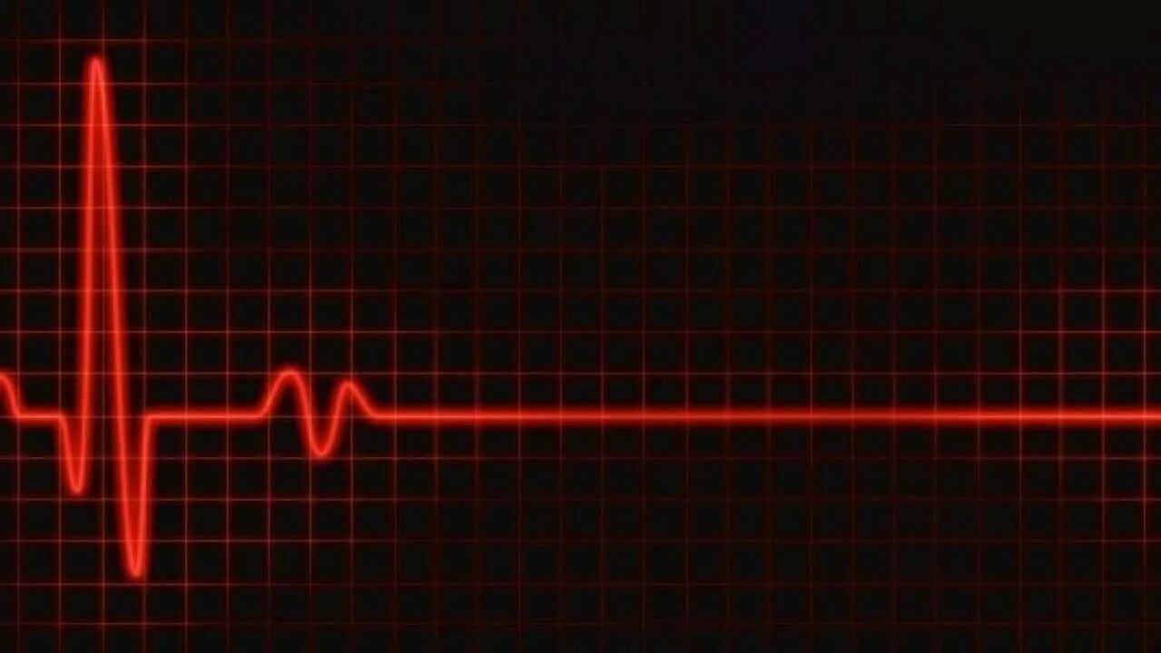 Как называется когда сердце бьется
