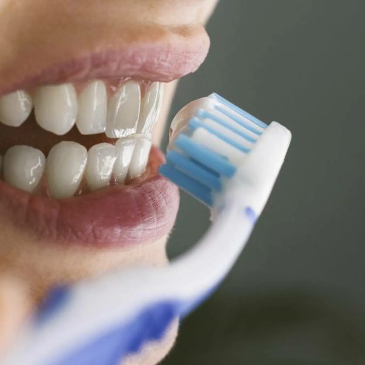 Гигиена зубов. Брашинг для зубов. Чистка зубов после лечения