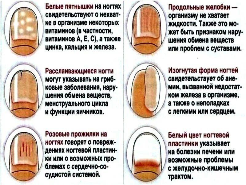 Почему ногти становятся жесткими. Выявление болезни по ногтям. Заболевания по ногтям рук. Определить заболевание по ногтям. Заболевания по ногтевой пластине.