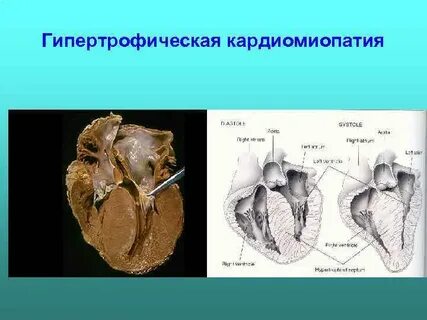 Гкмп