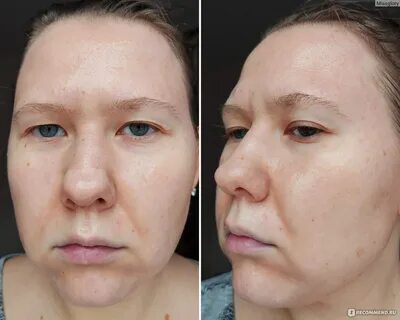 Лучший пилинг отзывы