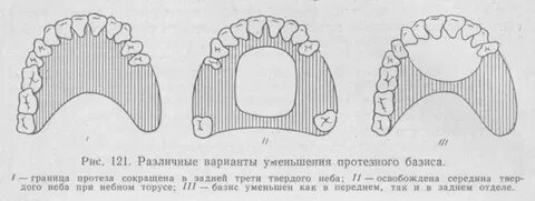 Границы нижней челюсти