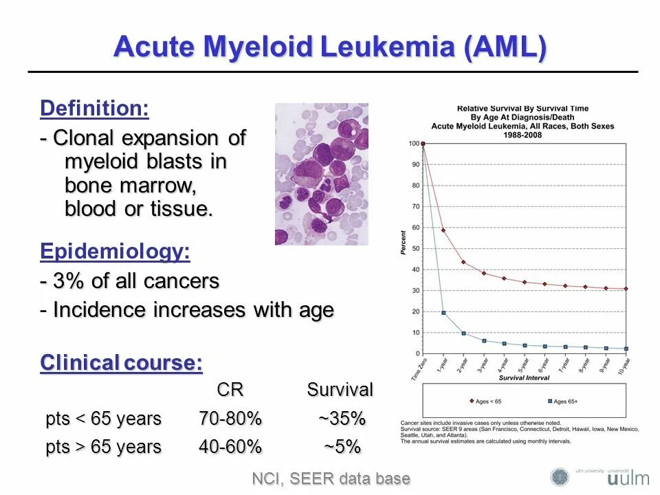 Acute myeloid Leukemia. AML система. AML Epidemiology. Acute Leukemia classification. Aml проверка cryptozen