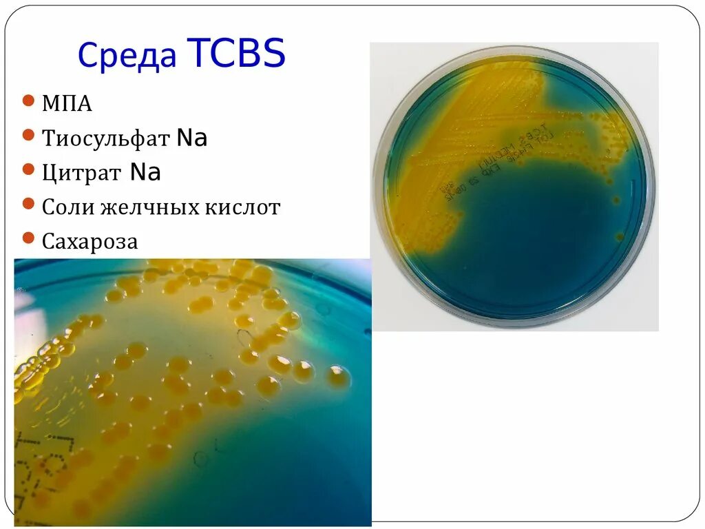 Холера питательные среды. Холерный вибрион на питательных средах. Среда TCBS. Среда TCBS микробиология. Среда TCBS вибрионы.