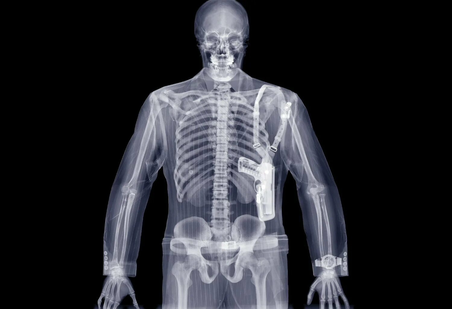 Рентген можно сделать. Рентгеновского излучения x- ray. XRAY рентген. Ник визи. X-ray men. Рентгеновский снимок человека.