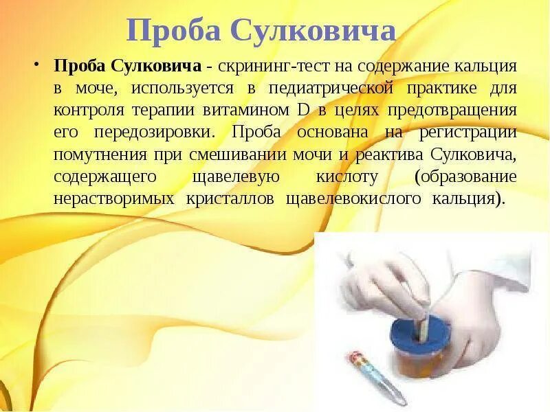 Сбор общего анализа мочи у детей алгоритм. Проба сулковича. мочи на пробу сулковича. исследование мочи по сулковичу. проба мочи по сулковичу.