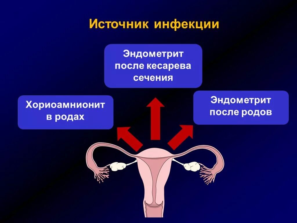 Источники послеродовой инфекции. Пути проникновения послеродовой инфекции. Можно забеременеть через рот