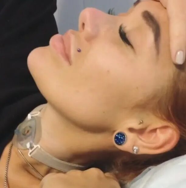 Tracheostomy: Uses, Procedure, Side Effects, and Results