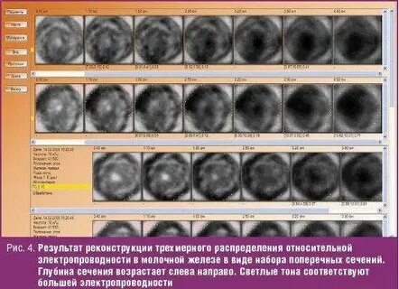 С 50.9 молочной железы