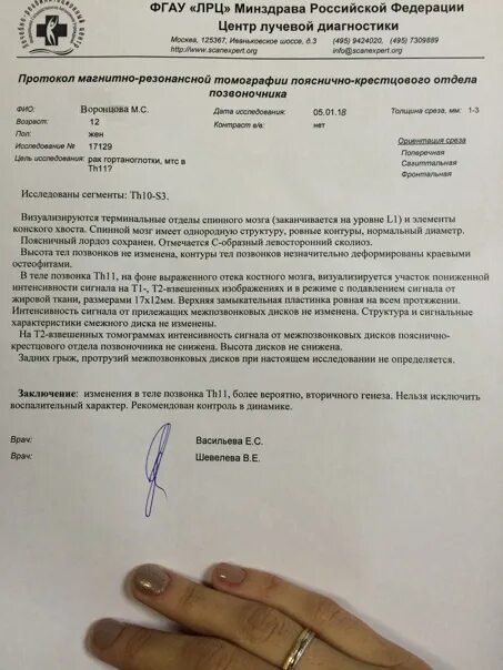 Рецепт кт