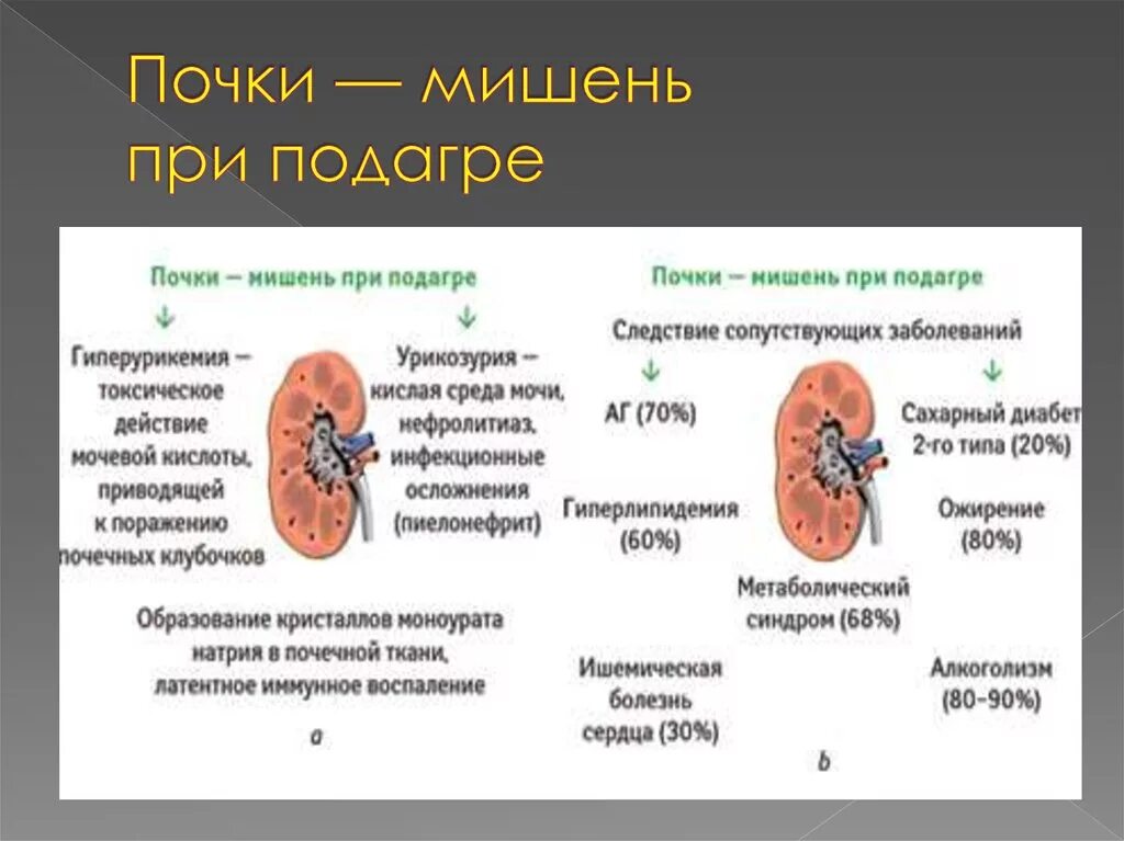 Исход заболеваний почек. Признак поражения почки при подагре. Признаком поражения почек при подагре является. Подагрическая нефропатия клиника.