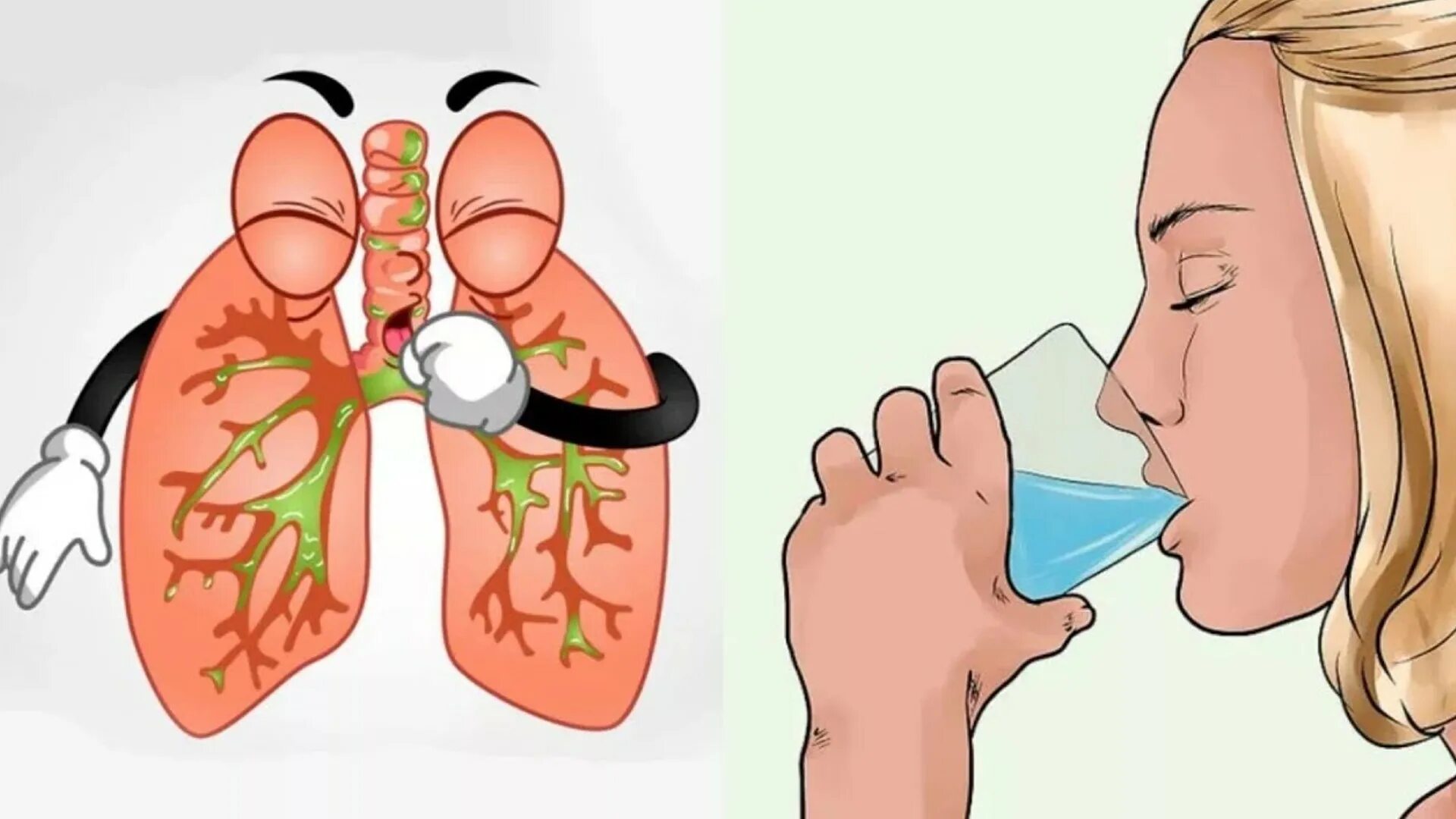 Как вылечить мокроту в домашних условиях
