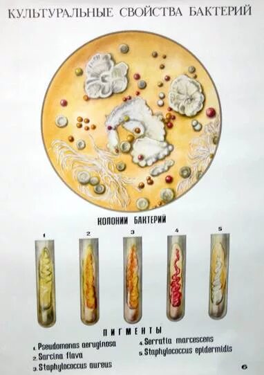 Культуральные свойства бактерий. Изучение культуральных свойств бактерий. Культуральные свойства микроорганизмов. Культуральные признаки бактерий.