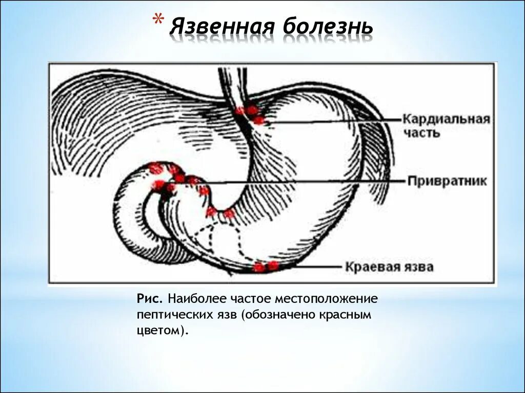 Привратник желудка анатомия. Строение желудка привратник. Кто такой привратник