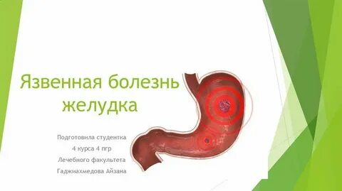 Сыр при язве желудка