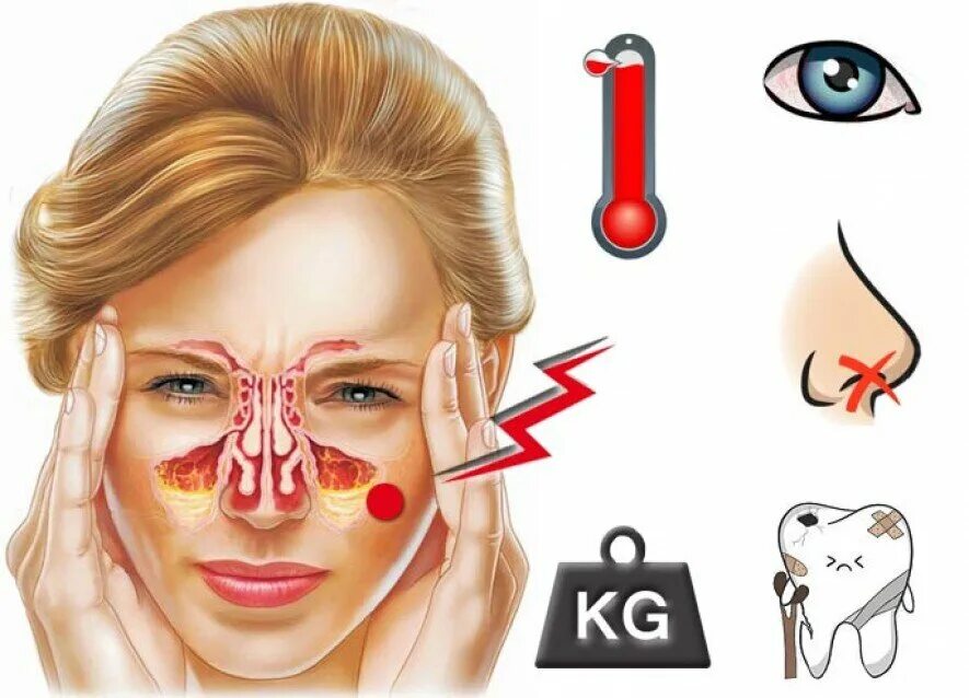 Синусит гайморит фронтит. Психосоматика гайморита и фронтита. Острый верхнечелюстной гайморит. Острая головная боль температура заложенность носа