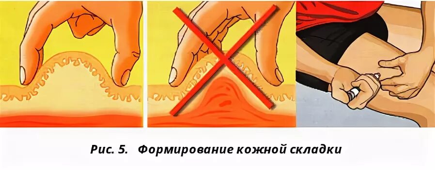 когда лучше колоть. когда лучше колоть. схема уколола витамина в12. как делать укол мильгамма. схема лечения алфлутопом.