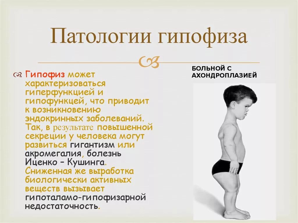 Что патология и тем. Нарушение функции патологии гипофиза. Патологии гормонов гипофиза. Гипофиз в детском возрасте. Врождённые заболевания гипофиза.